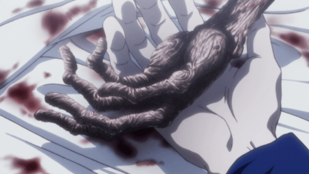 This was so gross, so well detailed that I felt like we all had to look at it again.